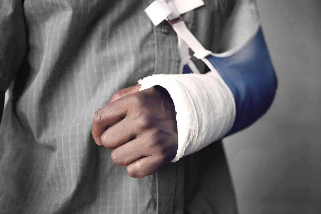 Closeup midsection of a man with broken arm in cast