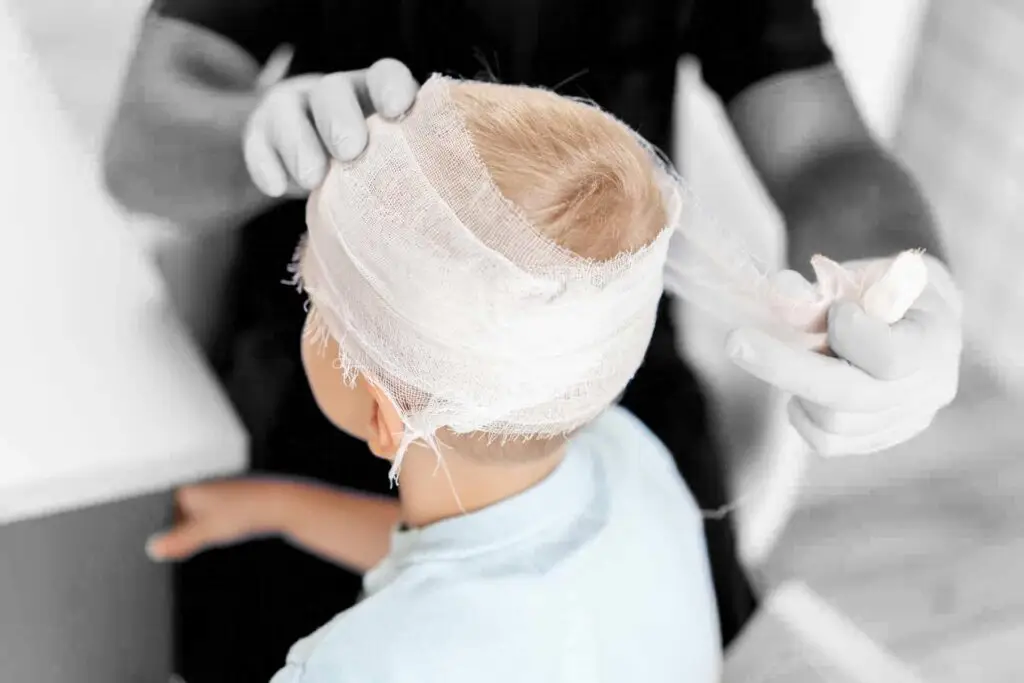 Blunt force trauma lawyer