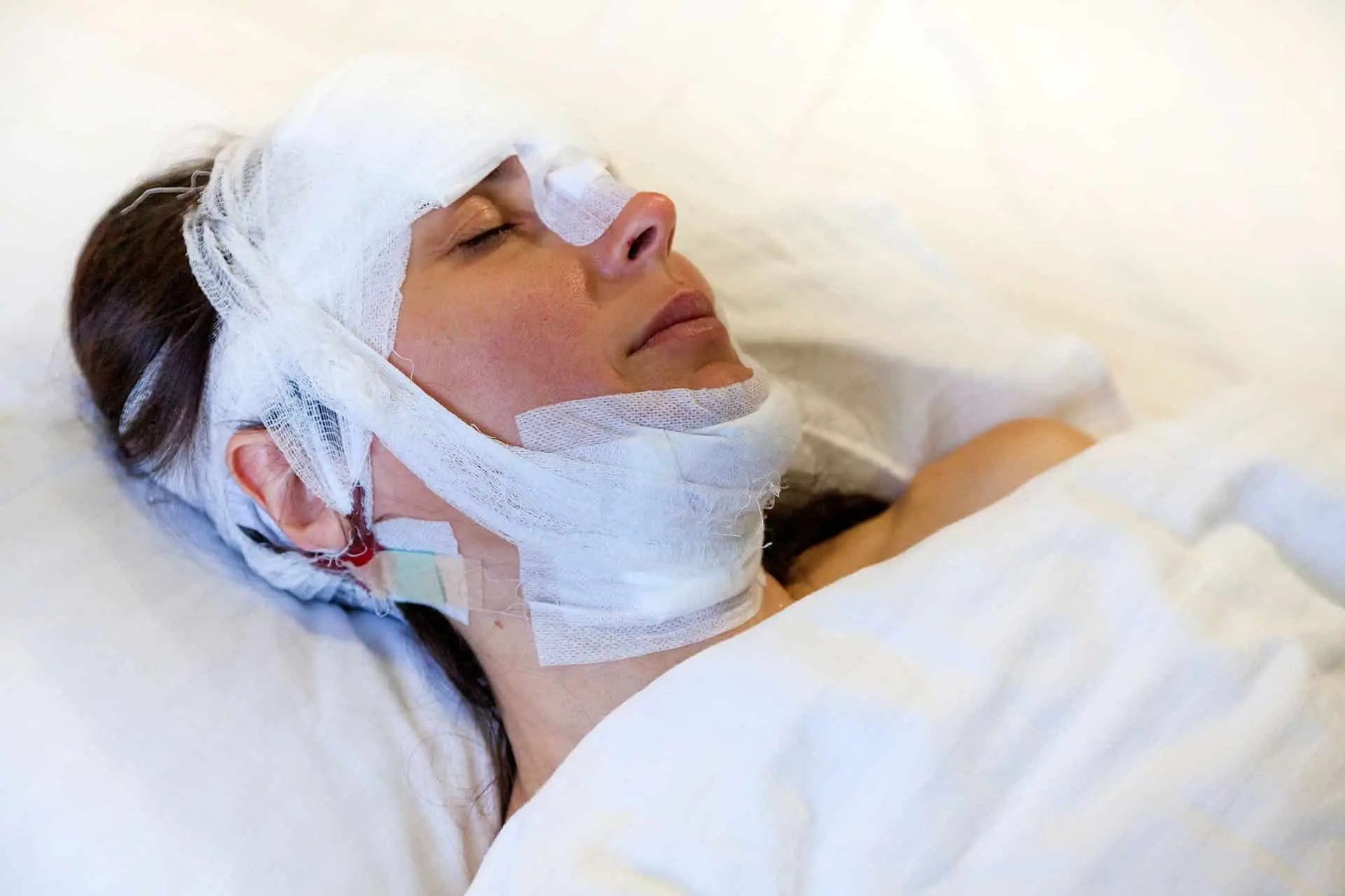 A girl after surgery with a bandaged head lies on the bed.