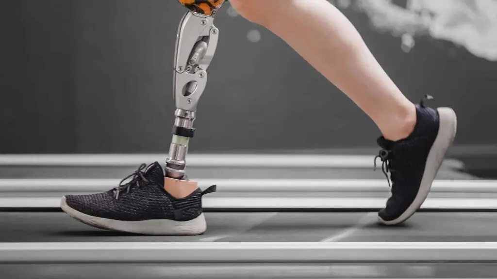 Woman with prosthetic leg using walking on treadmill while working out in gym.