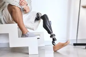 Man with prosthetic leg