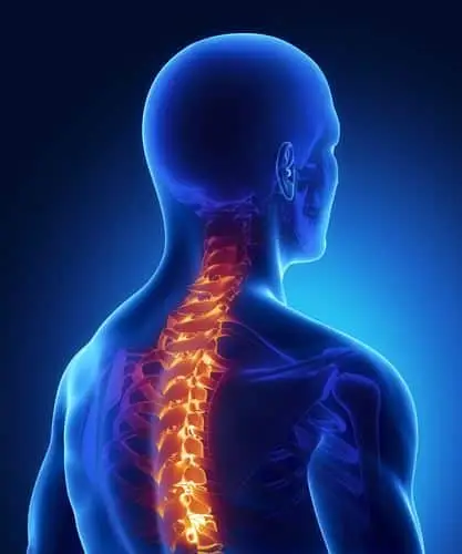 Whiplash and neck injury illustration